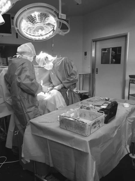 implantologie dans le traitement des séquelles de fentes labio maxillo palatines à Genève